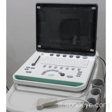 Laptop della macchina ad ultrasuoni per la clinica